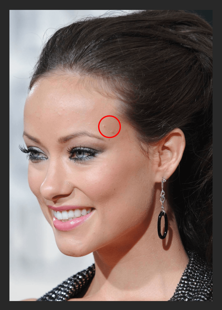 img/2019/06/vosstanavlivayusyaya-kist-14.png 942x1316