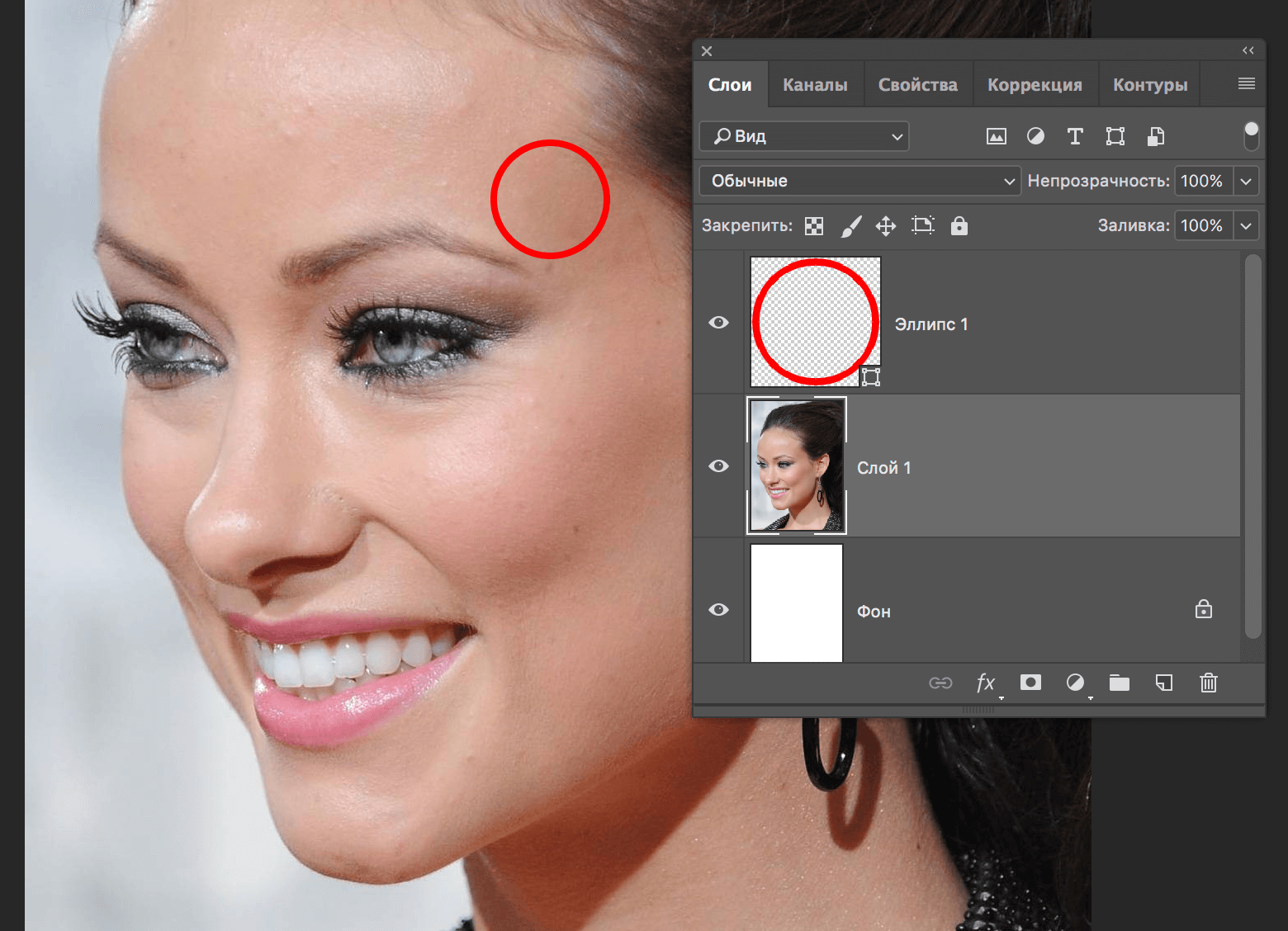 img/2019/06/vosstanavlivayusyaya-kist-15.png 1560x1128