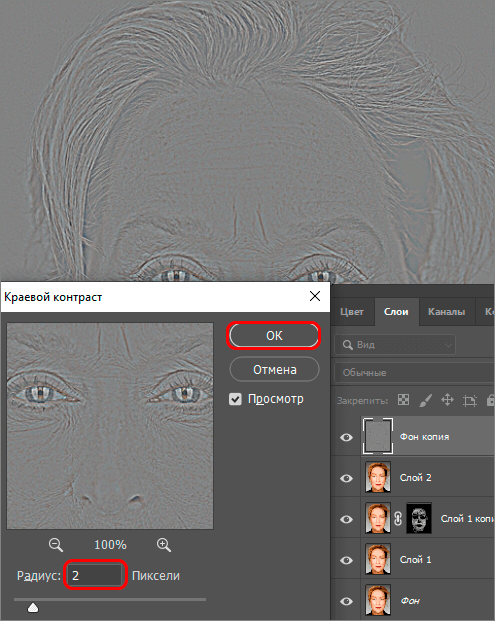 img/2019/08/izbavl-ot-morshin-19.png 495x621