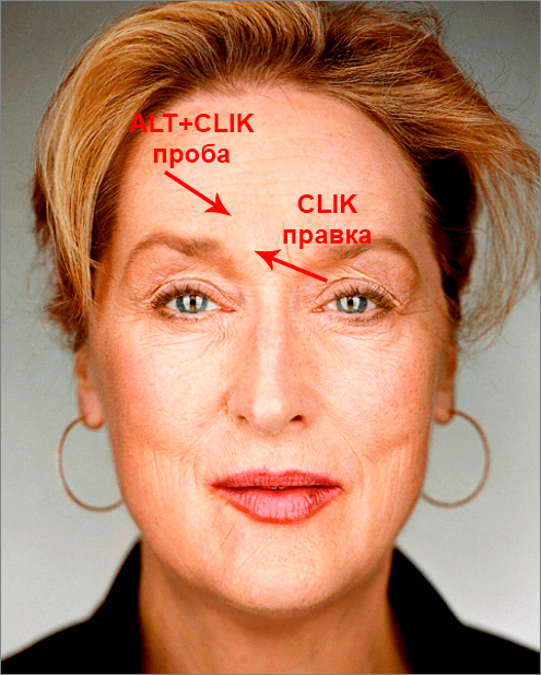 img/2019/08/izbavl-ot-morshin-3.png 495x618