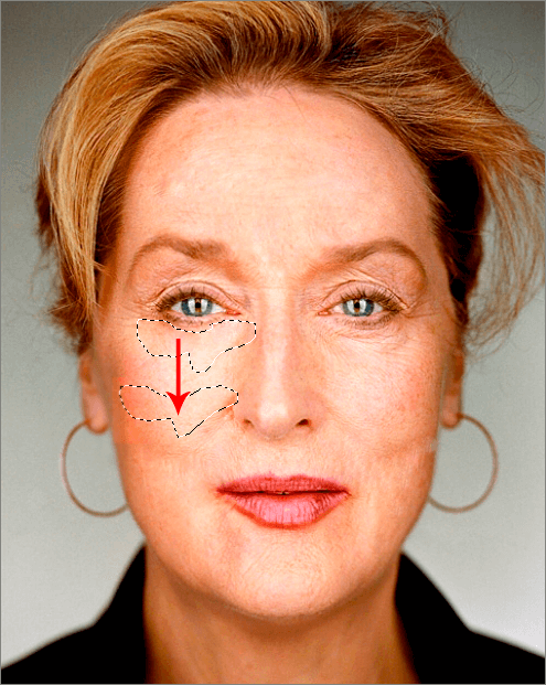 img/2019/08/izbavl-ot-morshin-5.png 495x621