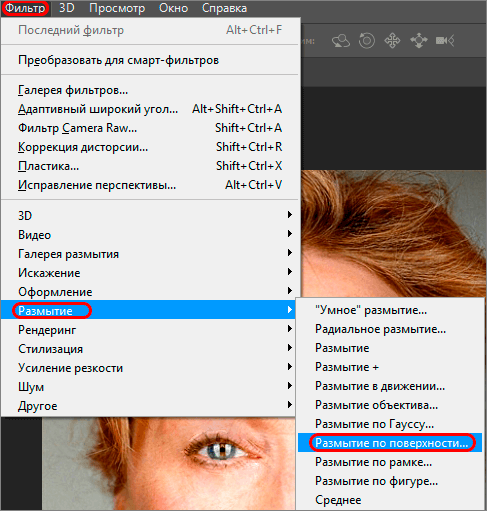 img/2019/08/izbavl-ot-morshin-7.png 487x511