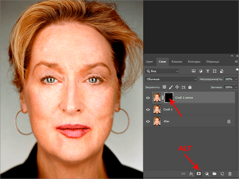 img/2019/08/izbavl-ot-morshin-9.png 828x621