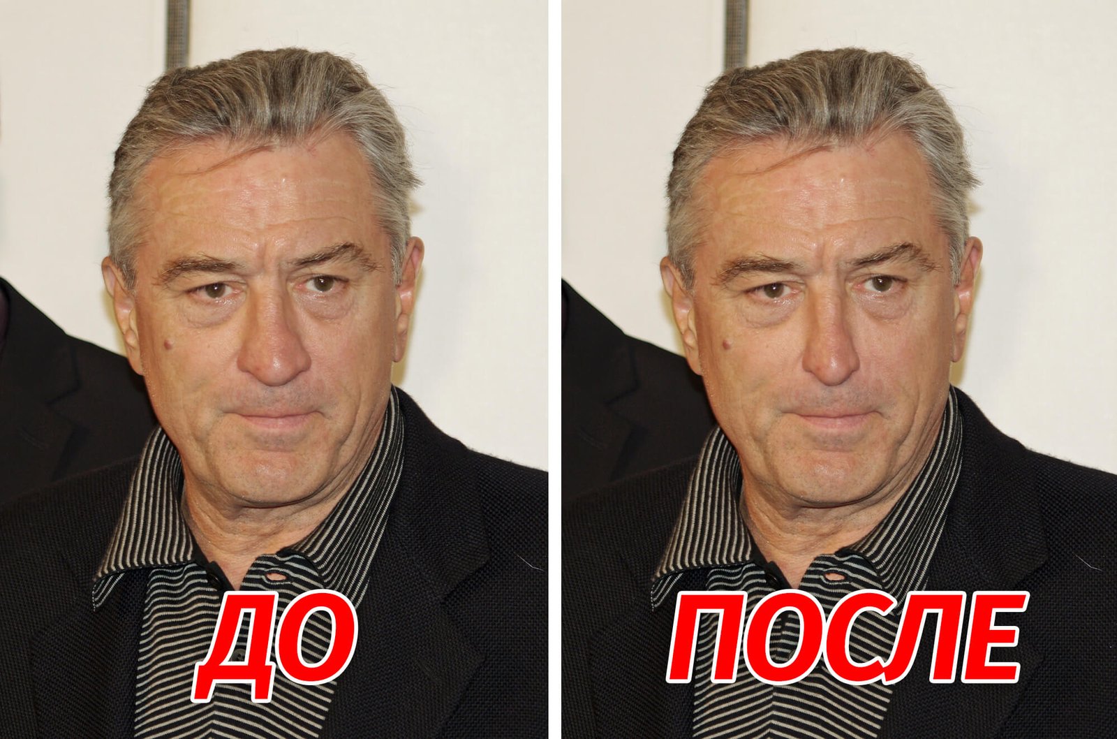 img/2019/08/umenshit-nos-12.jpeg 2000x1322