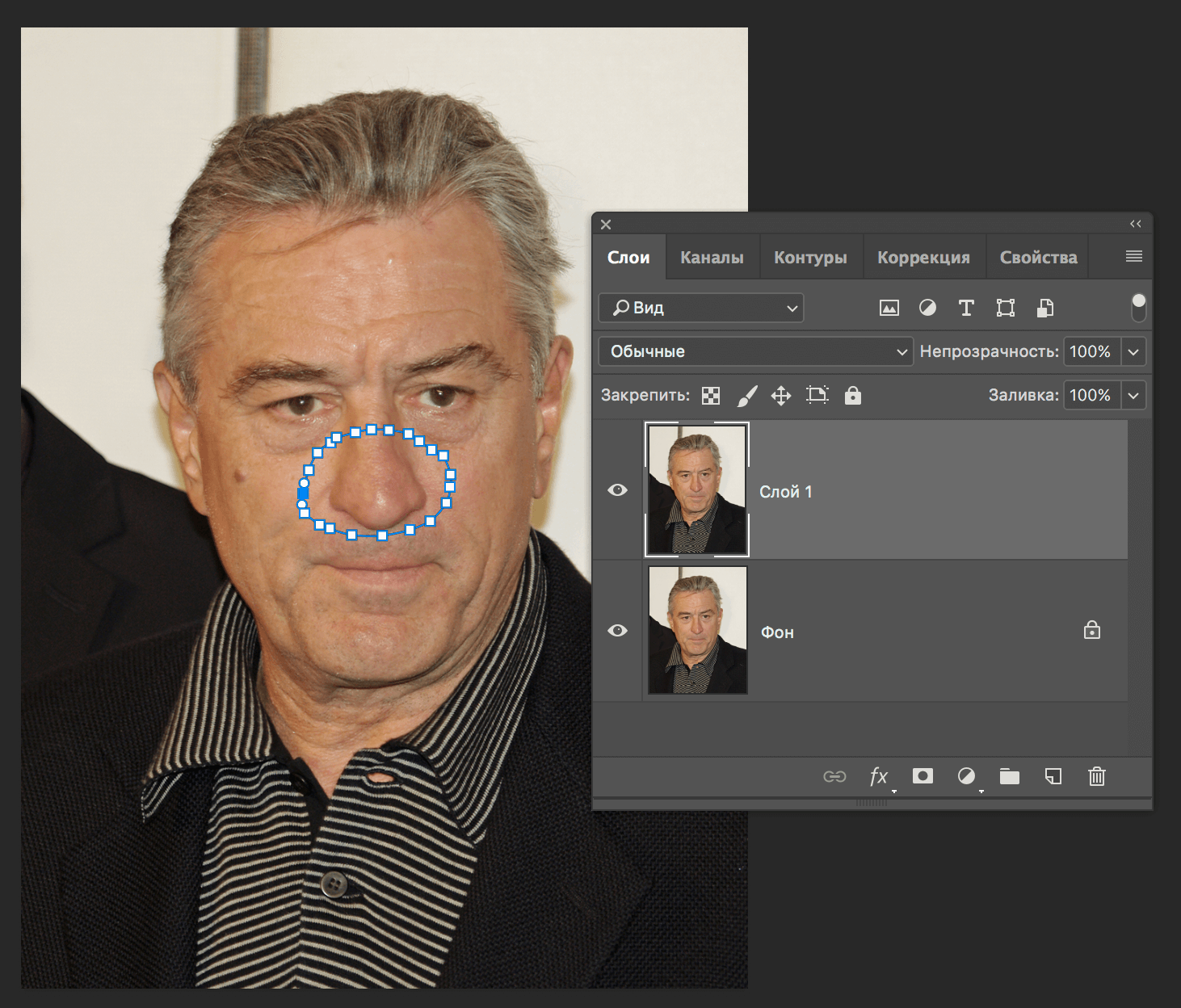 img/2019/08/umenshit-nos-4.png 1462x1248