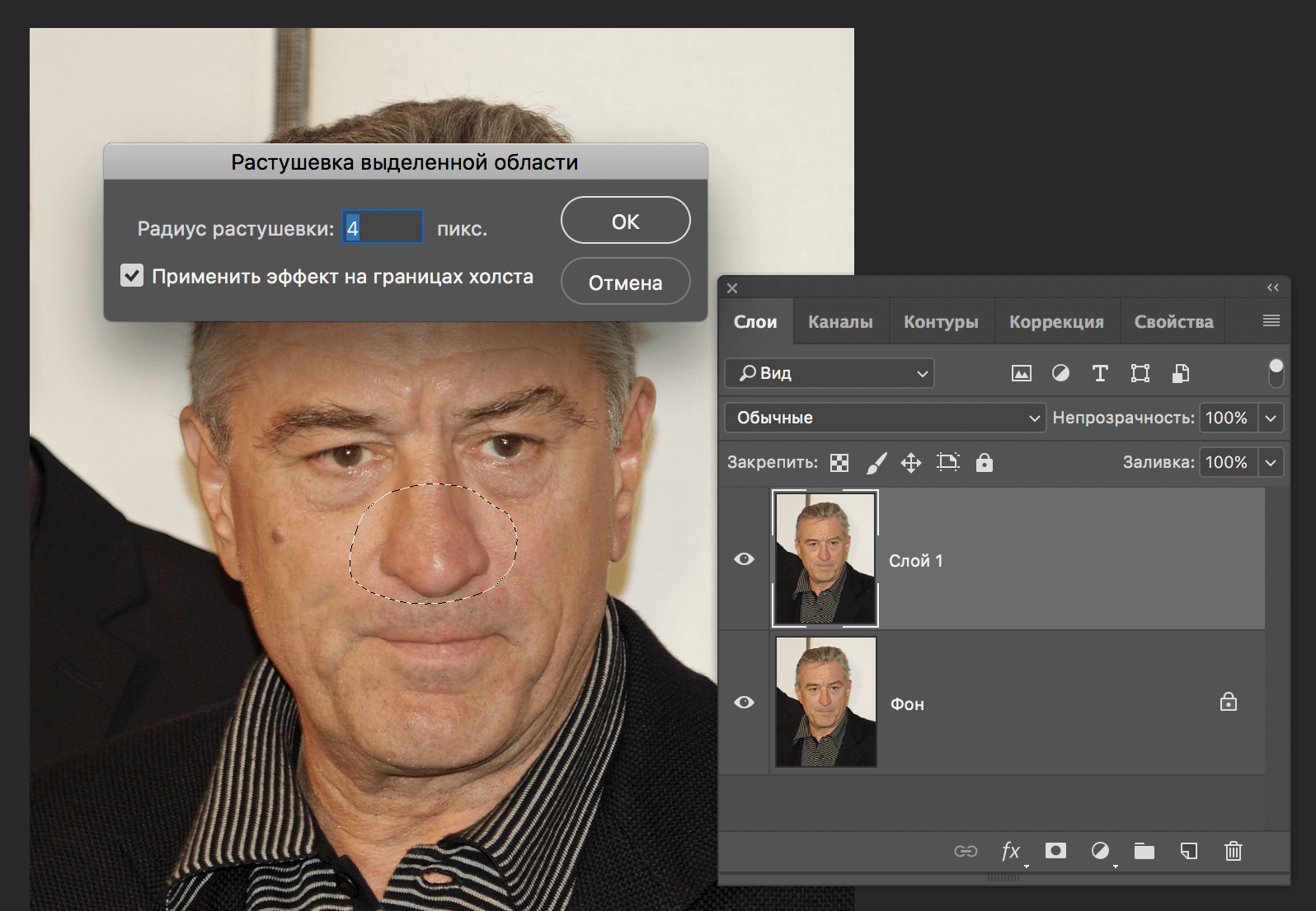 img/2019/08/umenshit-nos-5.png 1596x1106