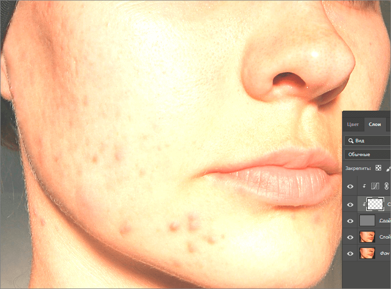 img/2019/08/vyravnivanie-tsvet-litsa-18.png 792x585