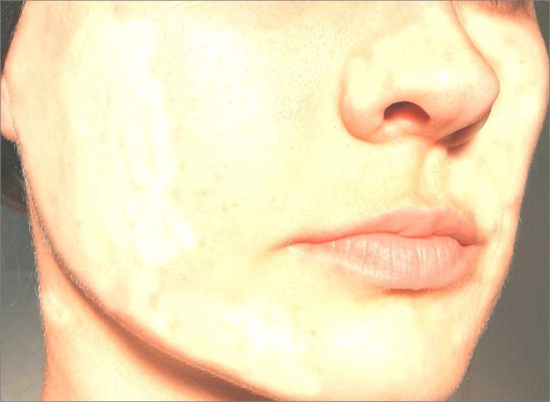 img/2019/08/vyravnivanie-tsvet-litsa-23.png 792x579