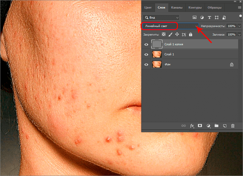 img/2019/08/vyravnivanie-tsvet-litsa-5.png 798x579