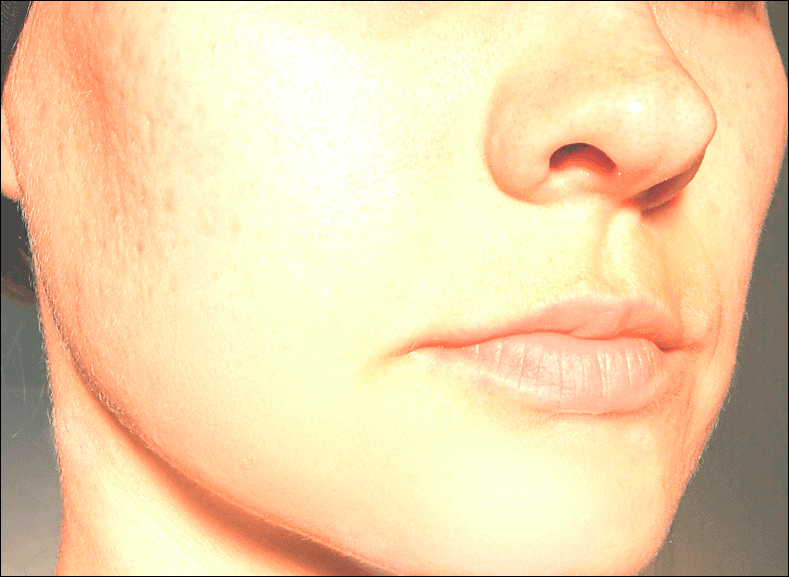 img/2019/09/vyravnivanie-tsvet-litsa-30.png 789x577