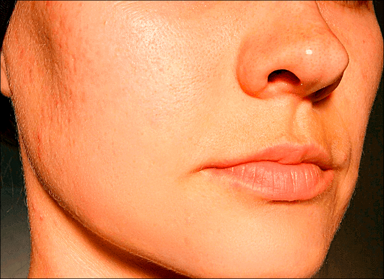 img/2019/09/vyravnivanie-tsvet-litsa-32.png 791x575