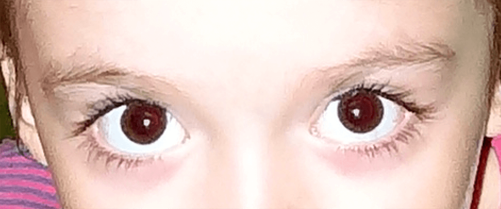 img/2019/11/effekt-krasn-glaz-foto-39.png 1000x417