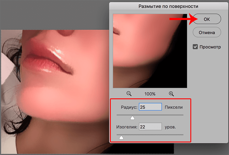 img/2020/03/udalenie-pryshey-photo-12.png 800x542