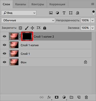 img/2020/03/udalenie-pryshey-photo-14-1.png 400x421