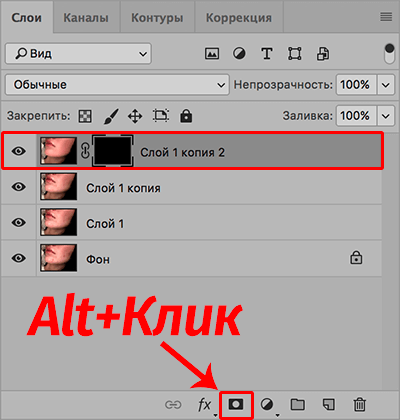 img/2020/03/udalenie-pryshey-photo-14.png 400x421