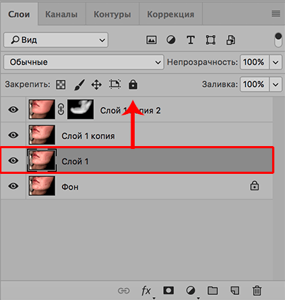 img/2020/03/udalenie-pryshey-photo-19.png 400x421