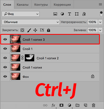 img/2020/03/udalenie-pryshey-photo-20.png 400x417