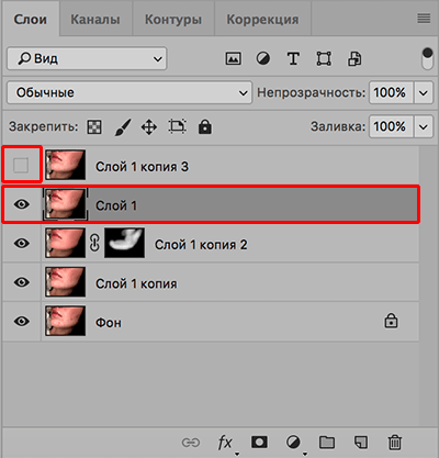 img/2020/03/udalenie-pryshey-photo-21.png 400x417