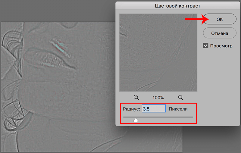 img/2020/03/udalenie-pryshey-photo-23.png 800x508