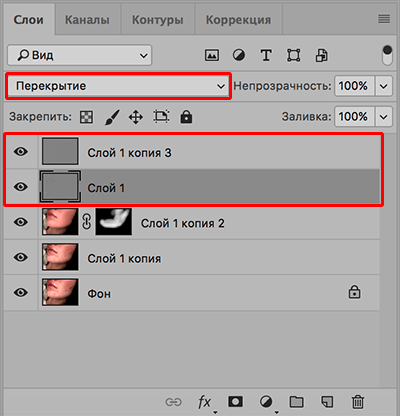 img/2020/03/udalenie-pryshey-photo-25.png 400x416