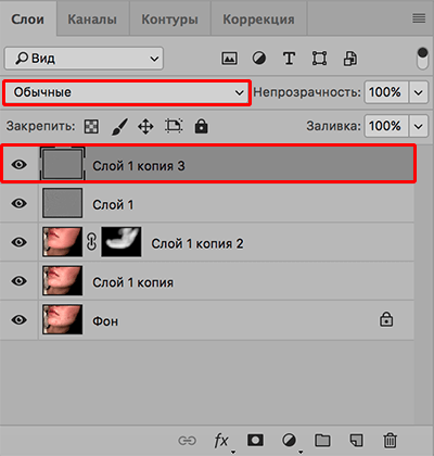 img/2020/03/udalenie-pryshey-photo-28.png 400x421
