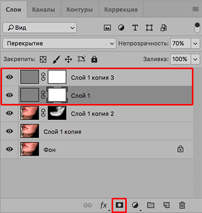 img/2020/03/udalenie-pryshey-photo-31.png 400x422