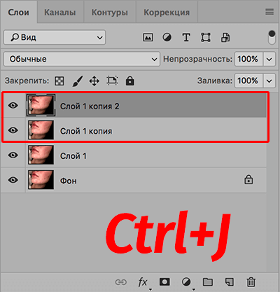 img/2020/03/udalenie-pryshey-photo-7.png 400x417