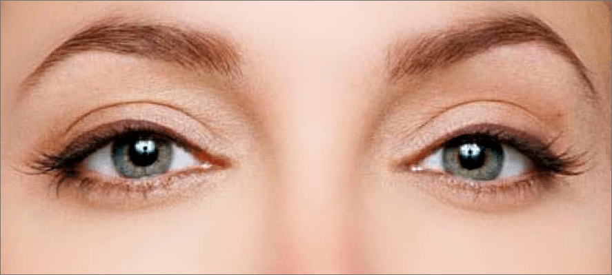 img/2021/01/belie-glaza-1.png 887x399